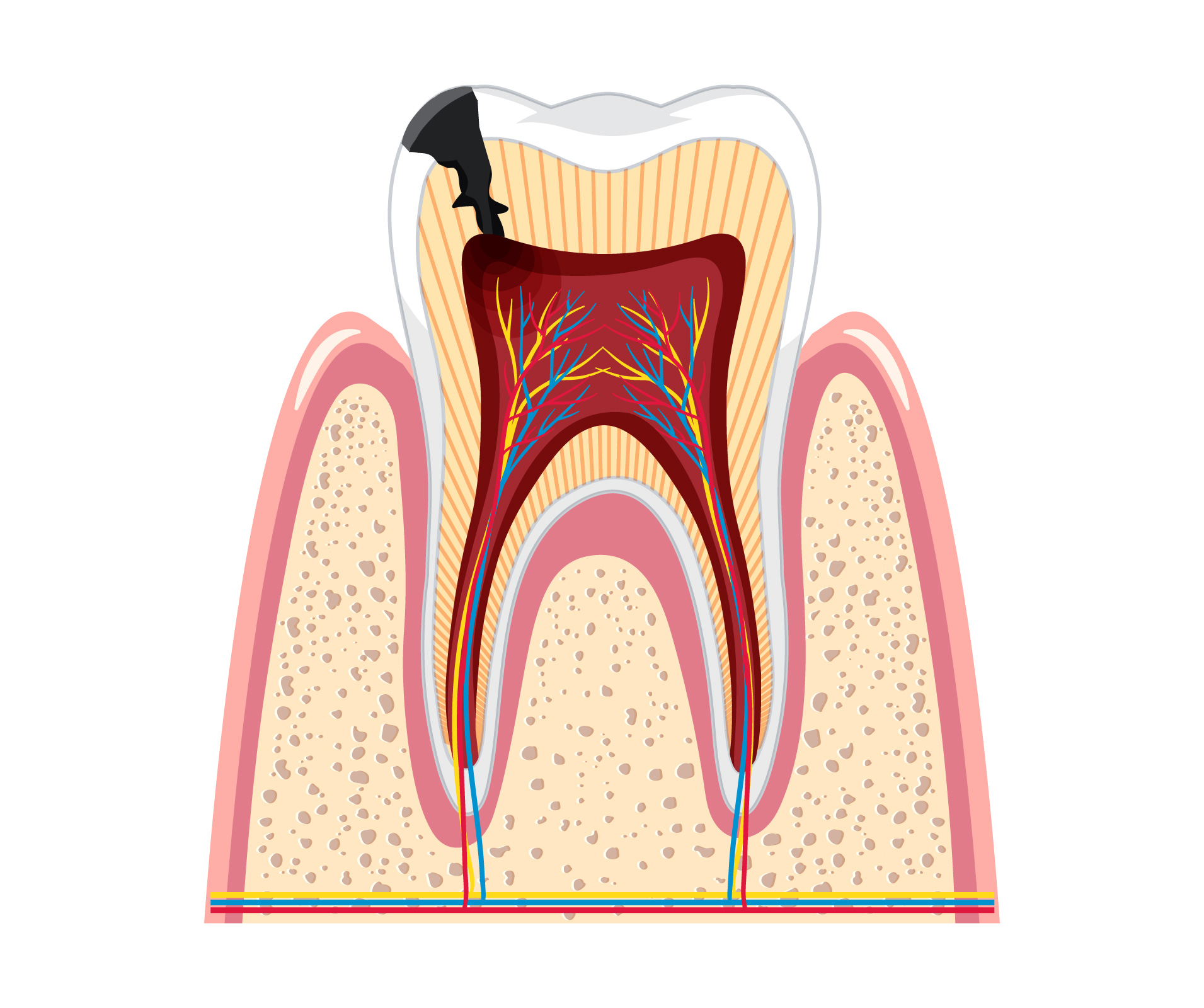 Endodonzia---Struttura-interna-dente-
