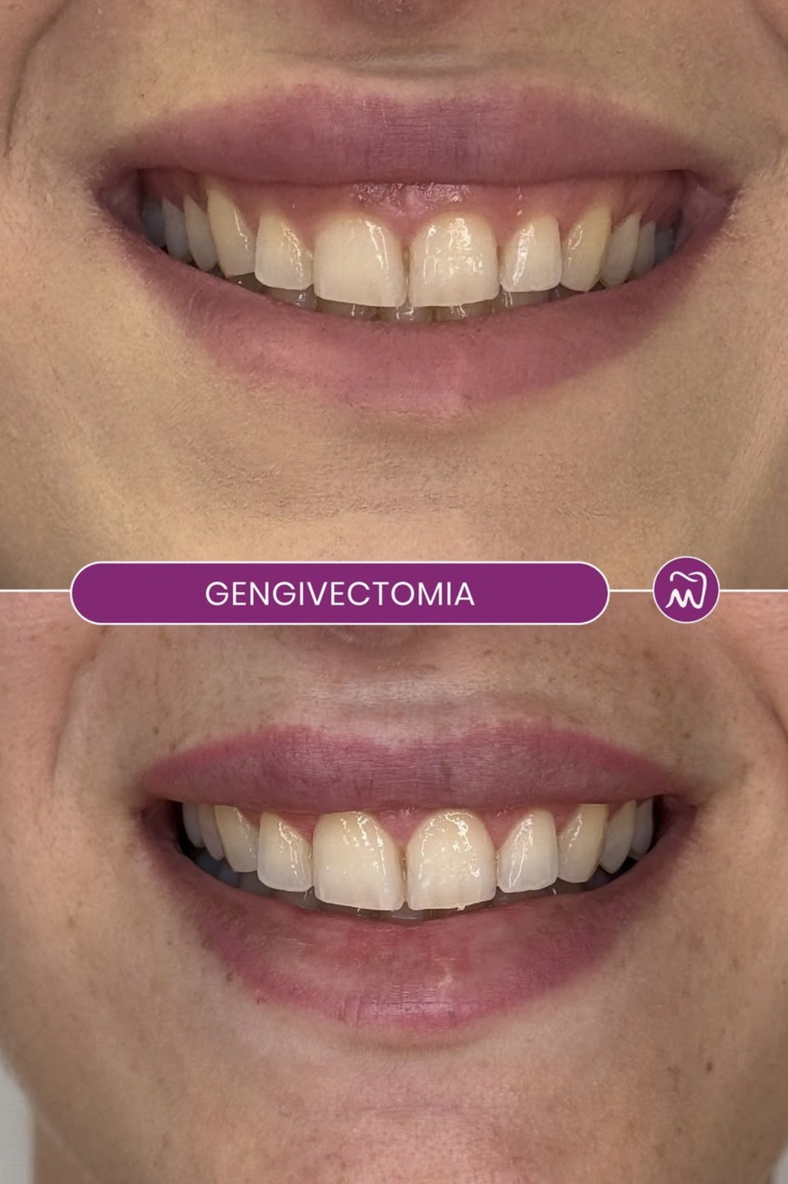 Sorriso Gengivale - Dentista Napoli