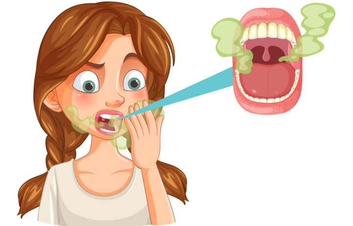 Alitosi cause e rimedi: illustrazione di una persona con alito cattivo e batteri nella bocca, problema legato a scarsa igiene orale, placca e patologie dentali