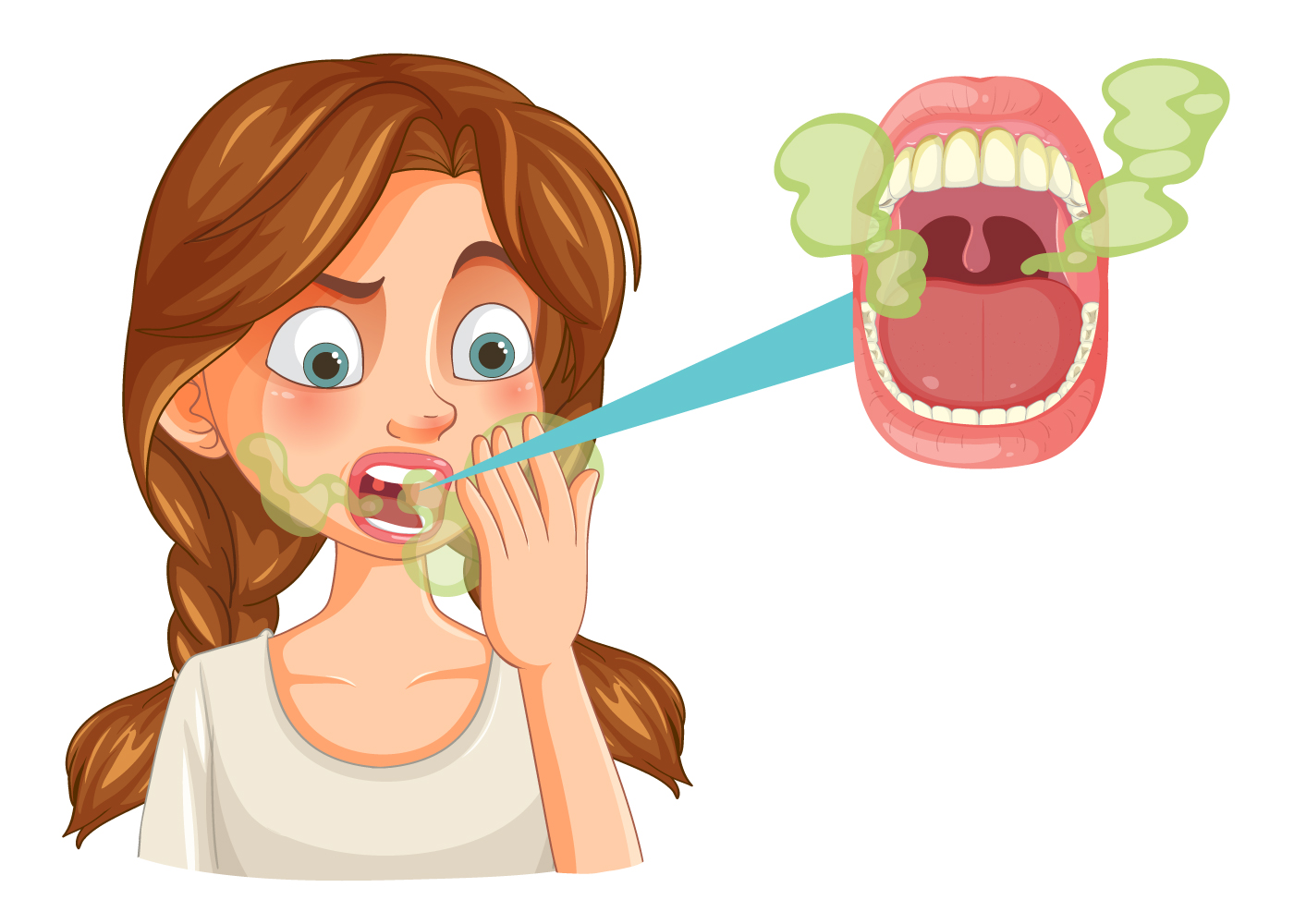 Alitosi cause e rimedi: illustrazione di una persona con alito cattivo e batteri nella bocca, problema legato a scarsa igiene orale, placca e patologie dentali